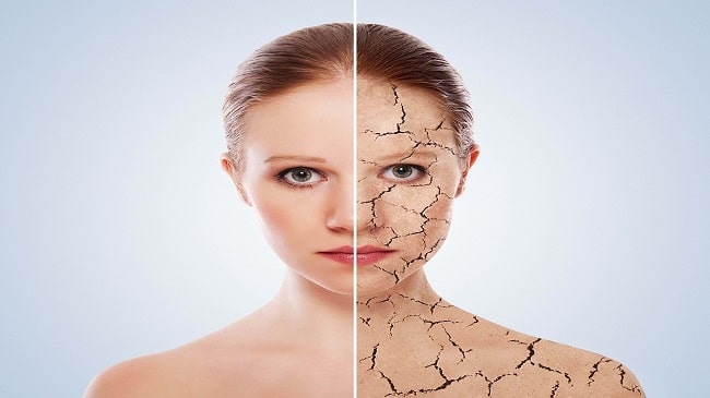تاثیر کم آبی بدن روی چشم